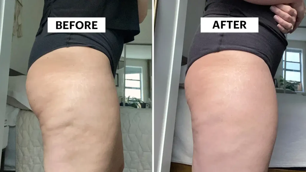 Do Toning Exercise Cumbernauld  Really Tackle Cellulite?
